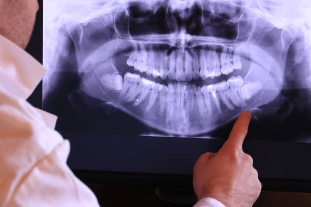 Best Urgent Care for Lost Fillings or Crowns in St Hedwig, TX