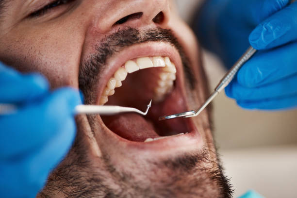 Best Emergency TMJ Treatment in St Hedwig, TX