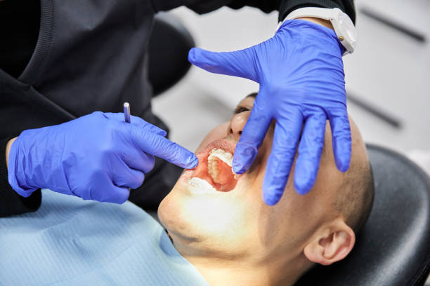 Best Emergency Dental Care for Broken or Chipped Teeth in St Hedwig, TX