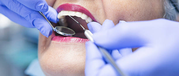 Best Emergency Gum Treatment in St Hedwig, TX